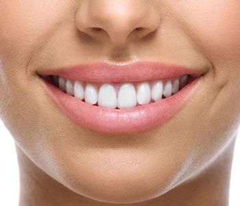 Best Smile Rejuvenation with Bioclear Method in Lawrence, KS area